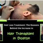 Hair-Loss-Treatment-The-Reasons-Behind-the-Increase-in-Hair-Transplant-in-Boston