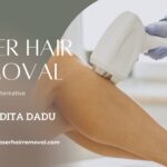 Laser Hair Removal Treatment