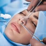 Rhinoplasty in Dubai