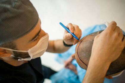 Hair Transplant in Riyadh