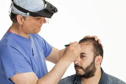 Hair Transplant in Riyadh