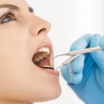 Know The Tooth Filling Cost Before You Proceed Woman at Dentist Miami