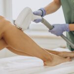 laser hair removal