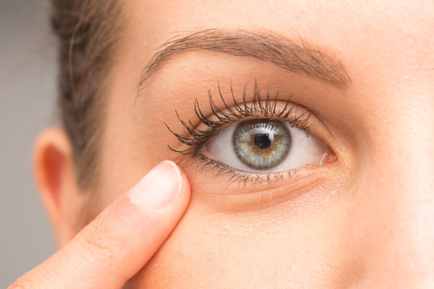 The Most Common Reasons People Choose Blepharoplasty