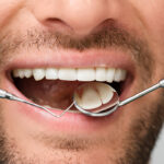 Periodontal Disease Treatment