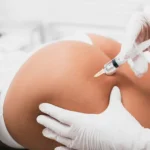 The Growing Trend of Butt Fillers in Dubai