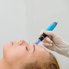 Exploring the Rise of Mesotherapy