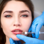 Lip Fillers Injection in Dubai