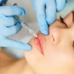 Lip Fillers Injection in Riyadh