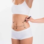 Liposuction Surgery in Jeddah