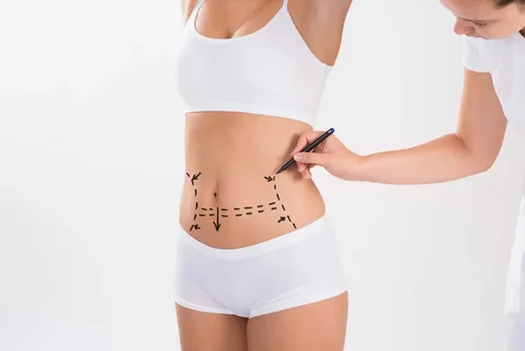 Liposuction in Jeddah