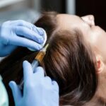 PRP Hair Treatment in Riyadh