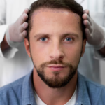 hair transplant in dubai price