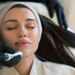 HydraFacial treatment in Noida