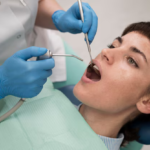 tooth extraction