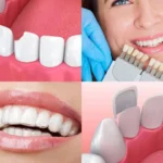 Cosmetic Dentist Tampa