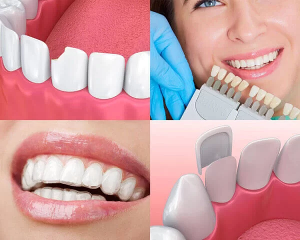 Cosmetic Dentist Tampa