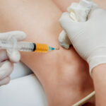 How Long Do PRP Injection Results Last for Knees?