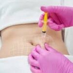 Lipolysis Injections in Dubai