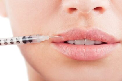 Say Hello to Fuller Lips: Lip Augmentation Options