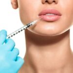 The Impact of Lip Reduction Surgery