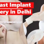 Breast implant surgery in Delhi