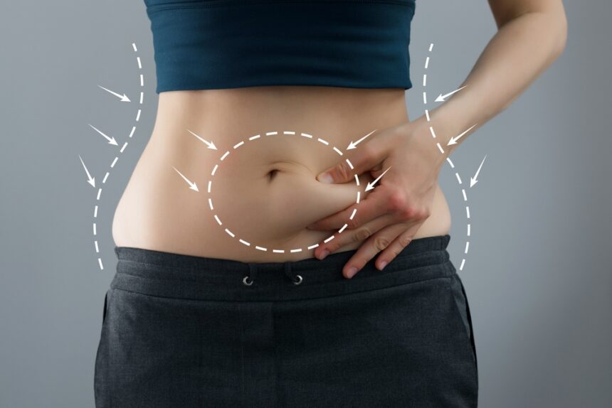 Achieving Natural Results with Mini Abdominoplasty