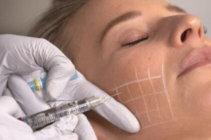 Restore Your Skin’s Vitality with Volite Fillers