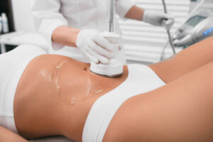 Advanced Body Contouring with Laser Liposuction