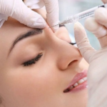 Botox Injection in Riyadh