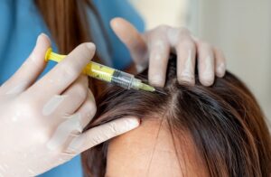 Effective PRP Hair Treatment for Hair Loss