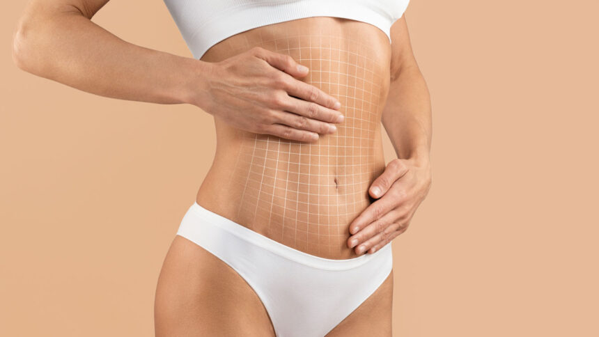 Expert Consultations for Mini Abdominoplasty