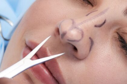 Latest Innovations in Closed Rhinoplasty Techniques