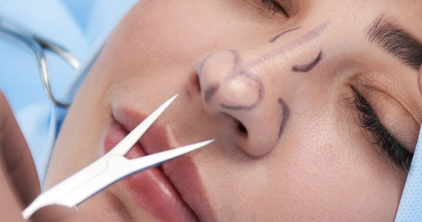 Latest Innovations in Closed Rhinoplasty Techniques