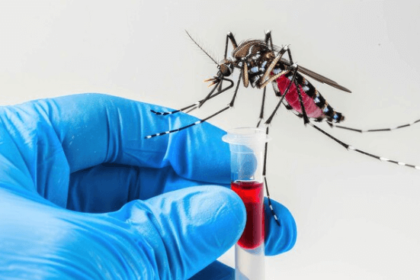 dengue test in delhi