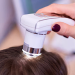 laser hair regrowth treatment dubai