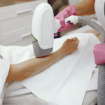 laser hair treatment bristol