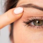 Advanced Eyelid Surgery Techniques Available