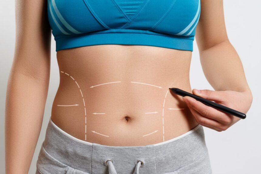 Best Areas for Liposuction Treatment