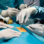 Gallbladder Surgeon in Guwahati