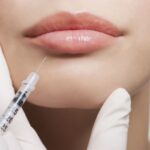 Comparing Lip Filler Brands Which One is Best