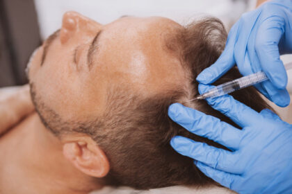 Fast and Effective Hair Regrowth with PRP