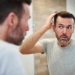 How to Choose the Right Hair Loss Treatment