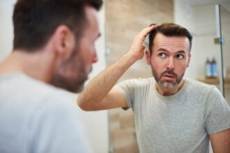 How to Choose the Right Hair Loss Treatment