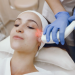 Laser Acne Scar Treatment for All Skin Types