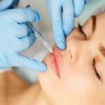 Lip filler injections in Riyadh