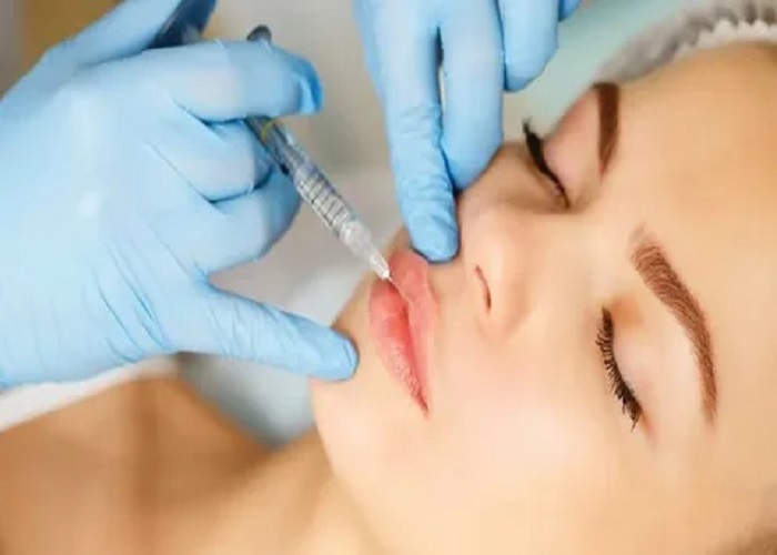 Lip filler injections in Riyadh