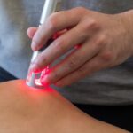 Low Laser Therapy for Postpartum Hair Loss