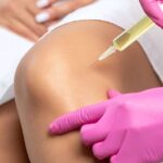 PRP Injections for Sports-Related Knee Injuries