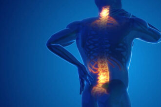 Back Pain Management